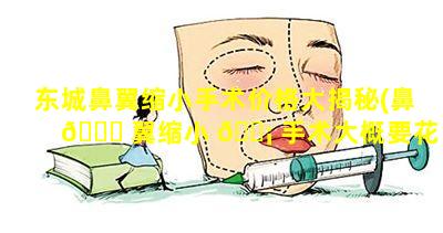 东城鼻翼缩小手术价格大揭秘(鼻 🐎 翼缩小 🐡 手术大概要花多少钱)